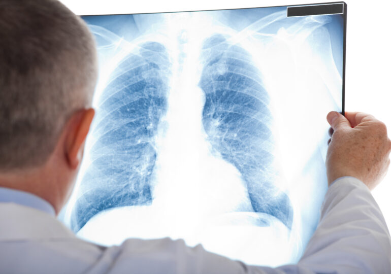 Consultații și screening pulmonar gratuit în Orhei: medici specialiști merg în localități