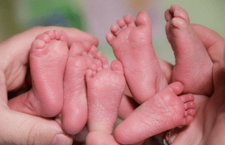 Caz medical extrem de rar. Tripleți identici s-au născut în Slovacia