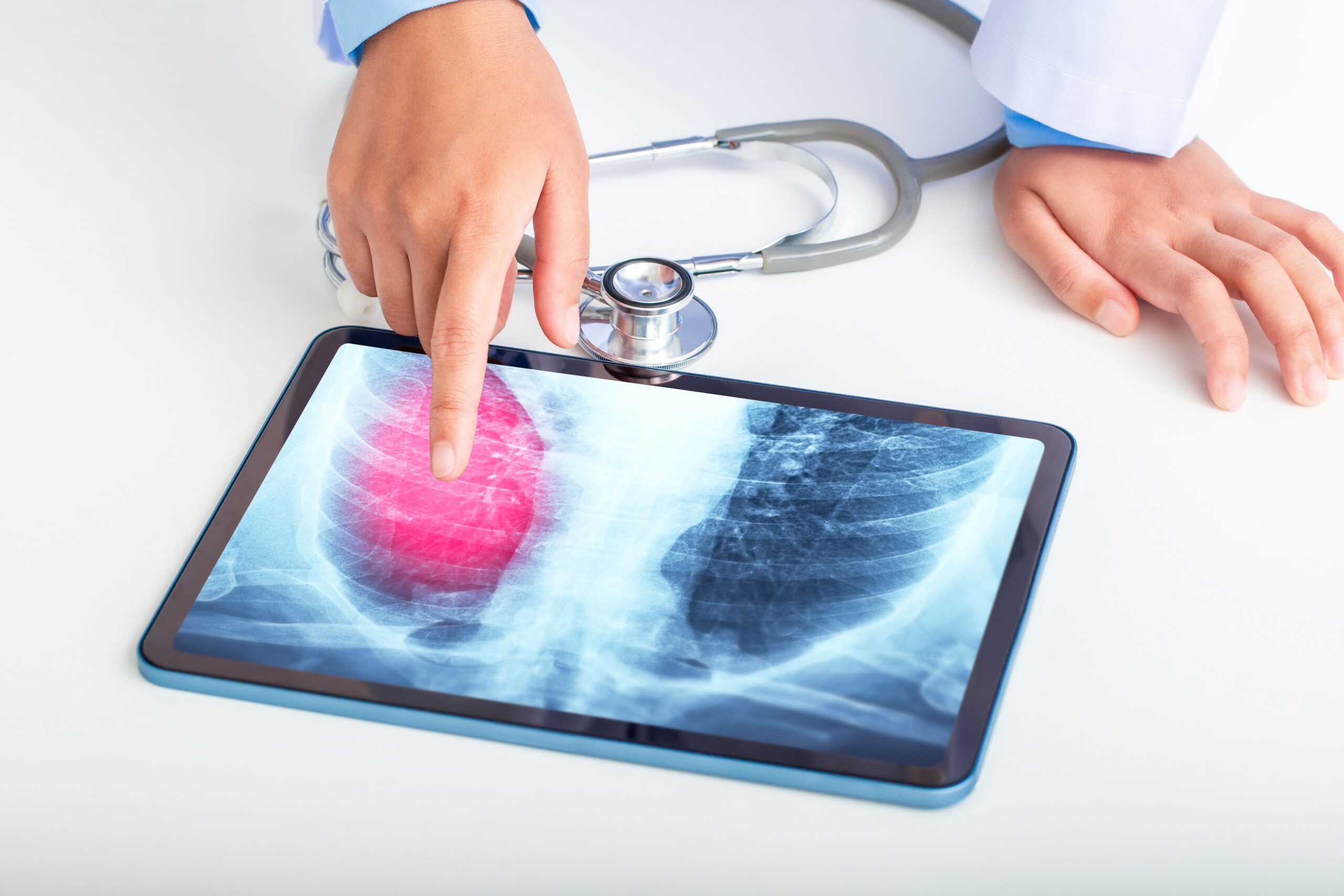 Screening pulmonar și servicii stomatologice gratuite pentru locuitorii din trei raioane