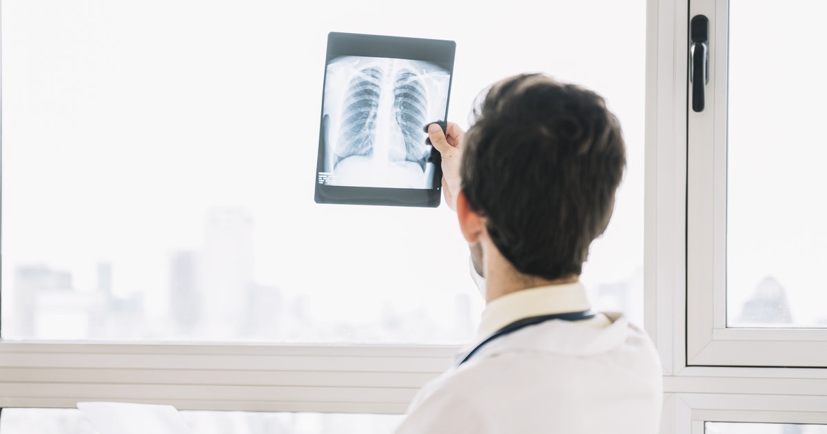 Screening pulmonar gratuit pentru cetățenii din raionul Hîncești