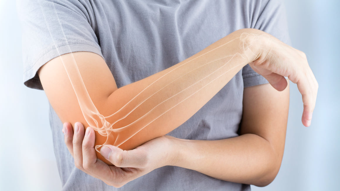 Un nou medicament pentru osteoporoză va fi compensat din 1 noiembrie. 5.000 de femei vor beneficia anual