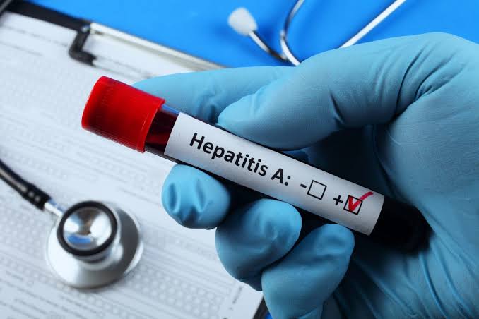 Cazurile de hepatită A s-au dublat față de anul trecut. Patru copii, printre persoanele diagnosticate
